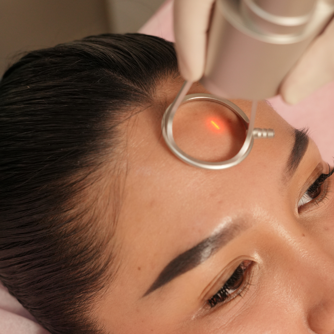 Warts Removal