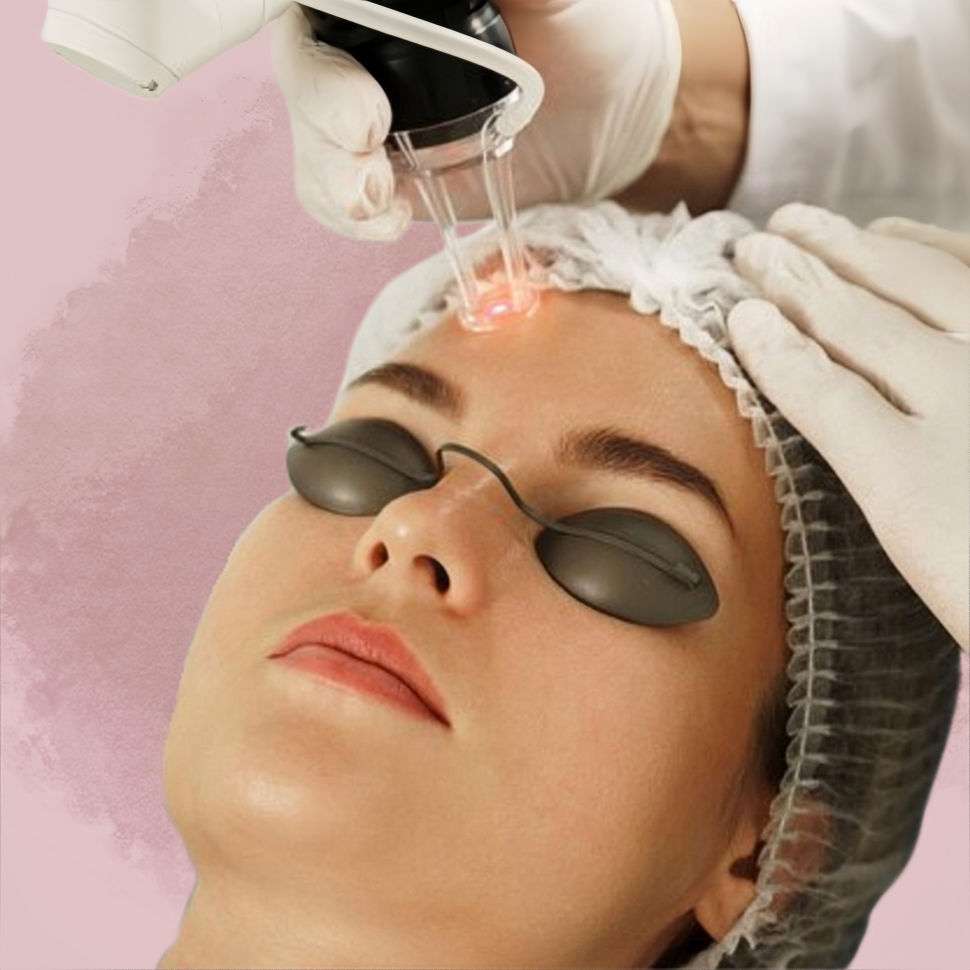 Rejuvenate your skin with Fractional CO2 Laser at Serenease. This treatment stimulates collagen production, reduces wrinkles & pores, and improves skin texture.